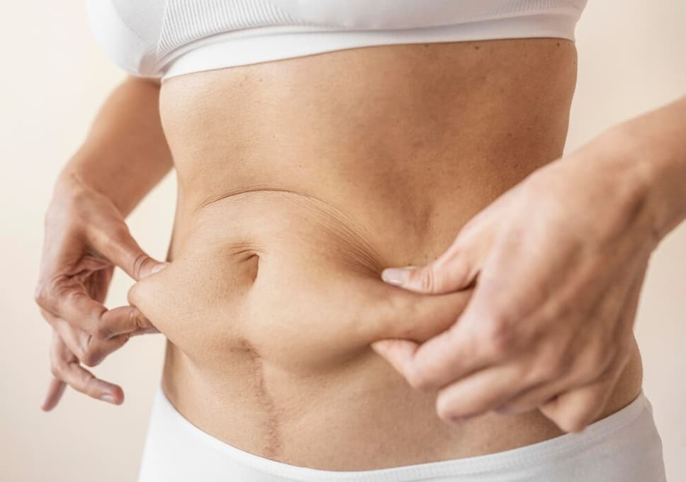 Close-up of a person pinching belly fat on their abdomen